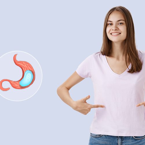 Mide Balonu Tedavisi